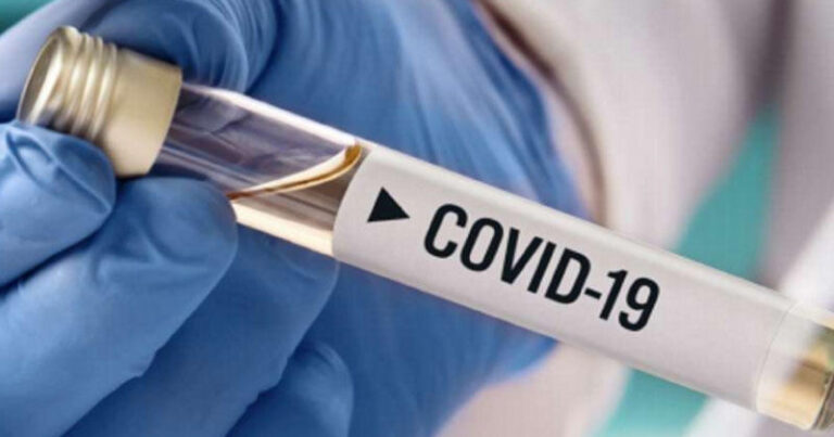 Azərbaycanda indiyədək 2782463 koronavirus testi aparılıb