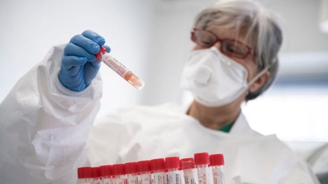 Azərbaycanda koronavirusun yeni ştammı aşkarlandı – RƏSMİ