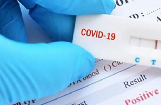 Rumıniyada koronavirusa yoluxanların sayı 1 milyonu keçdi