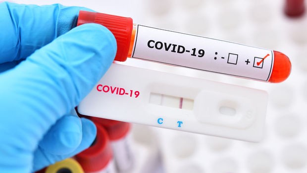 İranda daha 193 nəfər koronavirusdan öldü