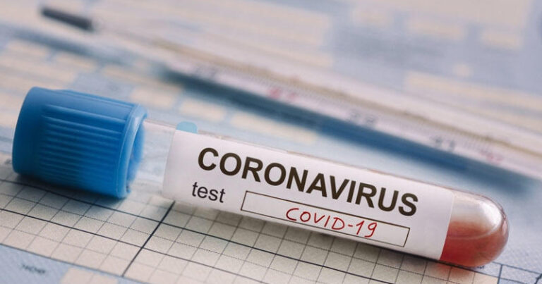 Rusiyanın 54 regionunda koronavirusun yeni ştammı aşkarlanıb