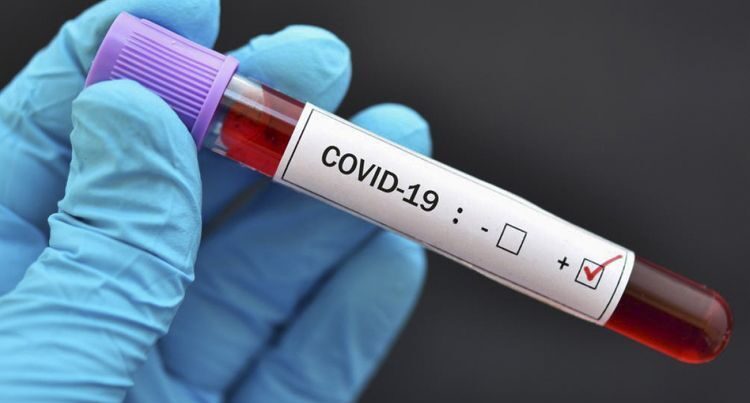 В России за последние сутки COVID-19 заразились 8646 человек