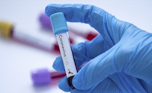 13 aktiv koronavirus xəstəsi ictimai yerlərdə saxlanıldı